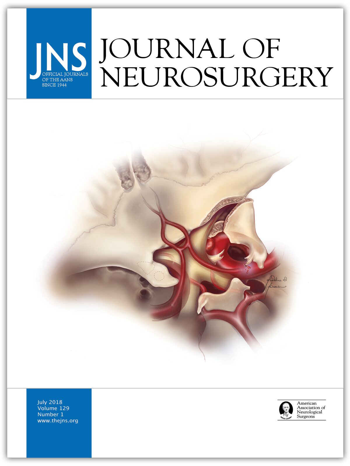 Journal of Neurosurgery | volume 129 issue 1