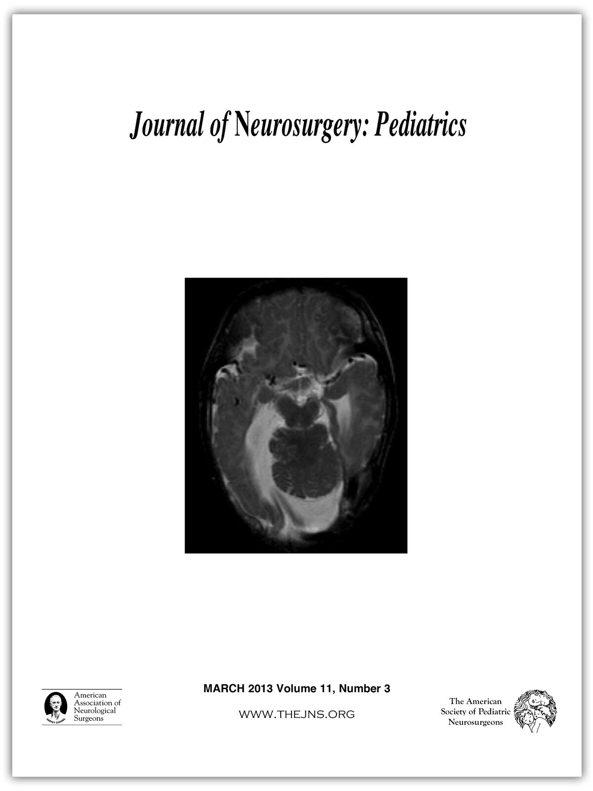 Journal of Neurosurgery: Pediatrics | volume 11 issue 3