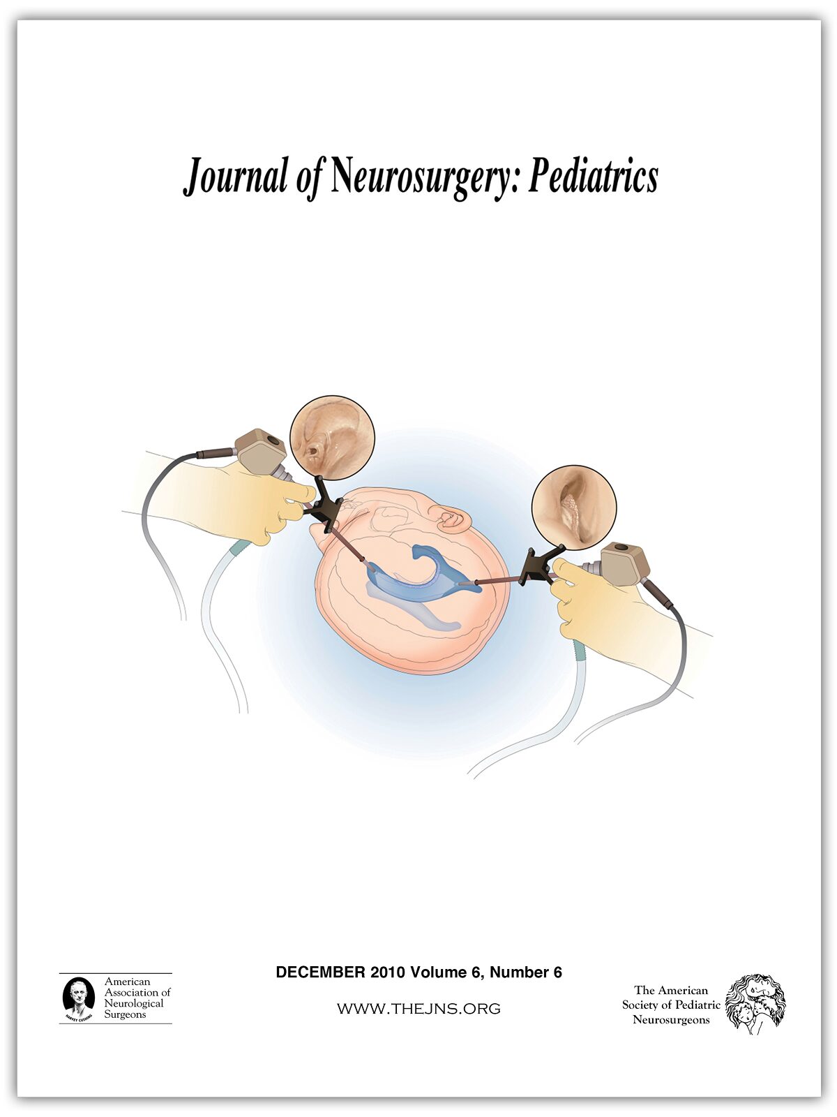 Journal of Neurosurgery: Pediatrics | volume 6 issue 6